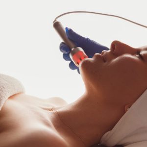 Servicio radiofrecuencia